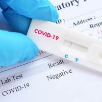 Covid-19 : Utilisation, à partir d’aujourd’hui, des tests de diagnostic rapides pour dépister les agents et cadres de la santé