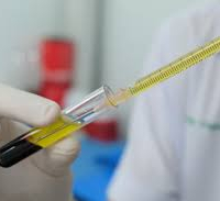 Un test sérologique est conseillé pour déterminer le degré d’immunité des malades guéris du coronavirus