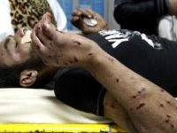 Siliana : les blessés par des tirs de chevrotine portent plainte contre Ali Laarayedh